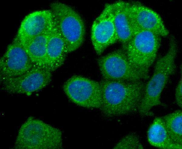 ICC staining Leptin Receptor in MCF-7 cells (green)