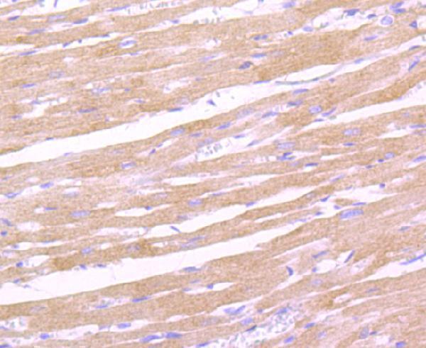 Immunohistochemical analysis of paraffin-embedded rat heart tissue using anti-Leptin Receptor antibody