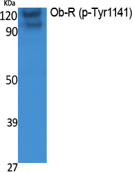 Western Blot analysis of extracts from K562 cells, using Phospho-Ob-R (Y1141) Polyclonal Antibody