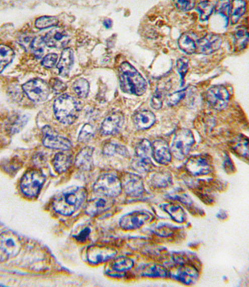 a00351 anti grb2 antibody y209 ihc p testing 2
