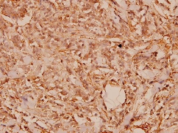 a00354 wnt1 primary antiboties ihc testing 2