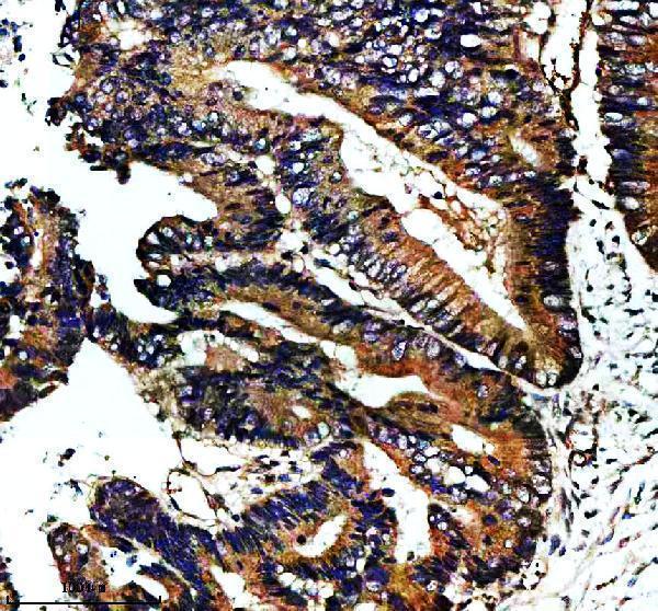 IHC analysis of NAV1 using anti-NAV1 antibody (A00355-1)