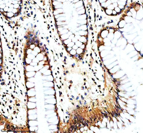 a00355 1 nav1 primary antibodies ihc testing 3