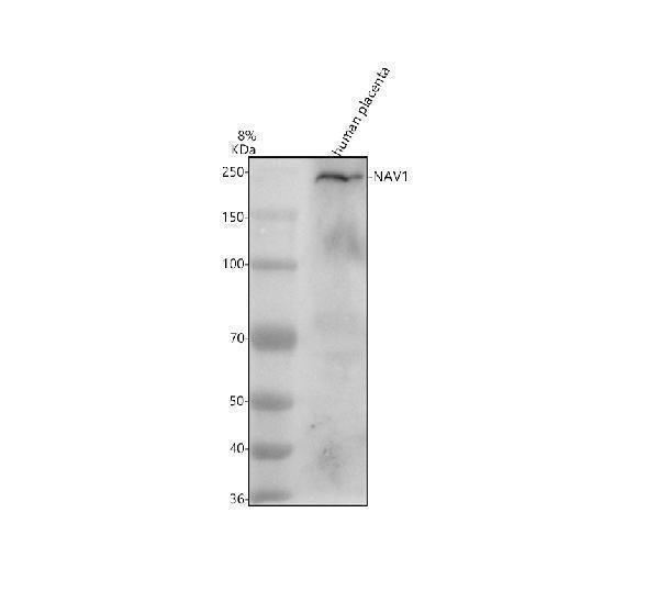 Western blot analysis of NAV1 using anti-NAV1 antibody (A00355-1)