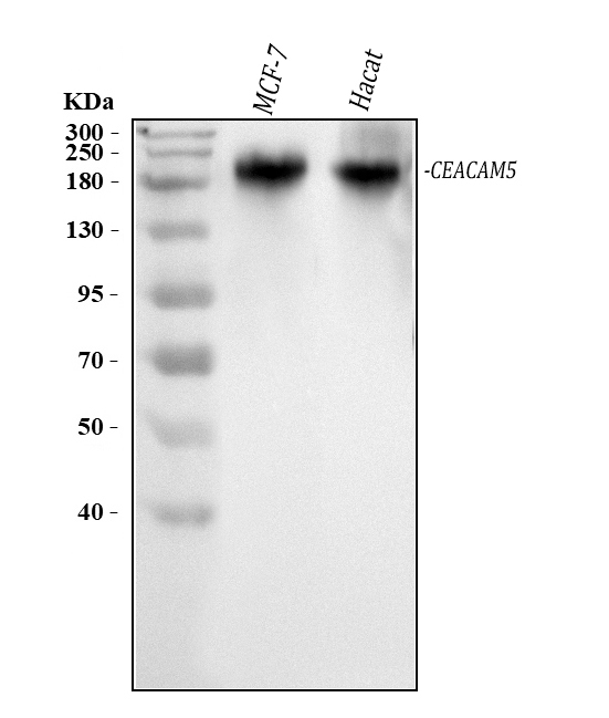  Western blot analysis of CEA/CEACAM5 using anti-CEA/CEACAM5 antibody (A00356-2)