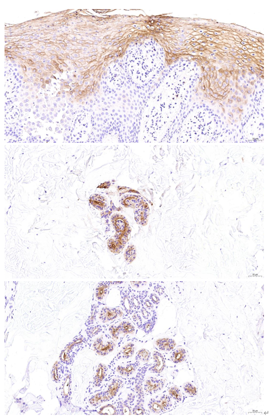 a00356 ceacam5 primary antibodies ihc testing 10