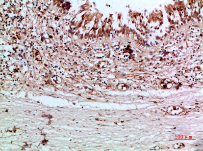 Immunohistochemistry validation of TG using Anti-Thyroglobulin TG Antibody (A00359)