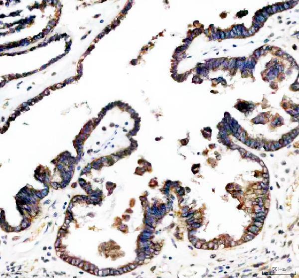 IHC analysis of CD47 using anti-CD47 antibody (A00360-1)