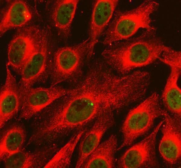 a00361 1 etv6 primary antibodies if testing 1