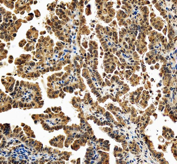 a00361 1 etv6 primary antibodies ihc testing 1