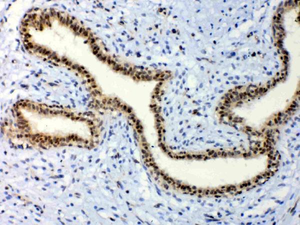 a00361 1 etv6 primary antibodies ihc testing 2