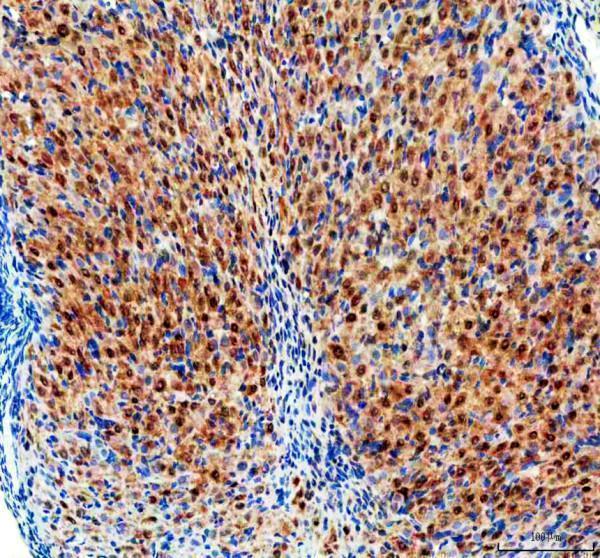 a00361 1 etv6 primary antibodies ihc testing 2_1