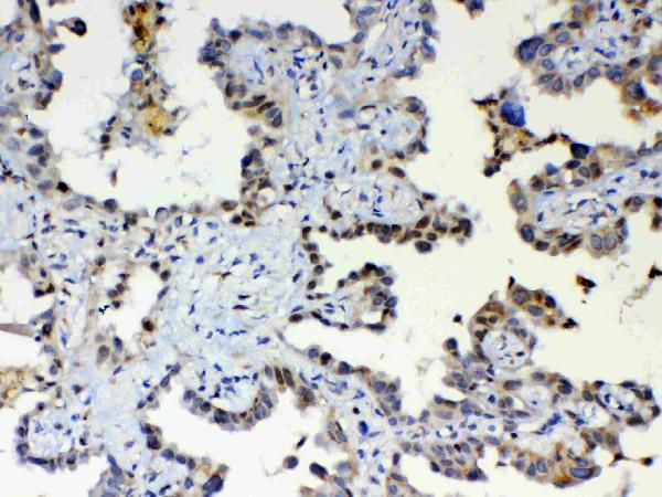 a00361 1 etv6 primary antibodies ihc testing 3