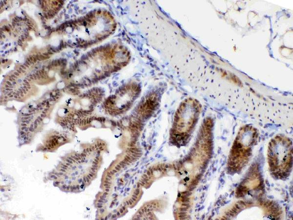 a00361 1 etv6 primary antibodies ihc testing 4