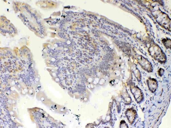 a00361 1 etv6 primary antibodies ihc testing 5