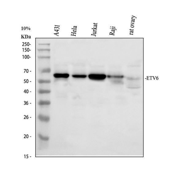 a00361 1 etv6 primary antibodies wb testing 1_2