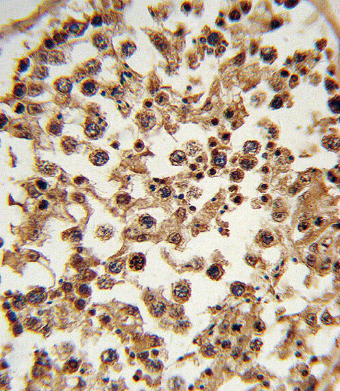 Formalin-fixed and paraffin-embedded human testis tissue reacted with ETV6 Antibody (N-term), which was peroxidase-conjugated to the secondary antibody, followed by DAB staining