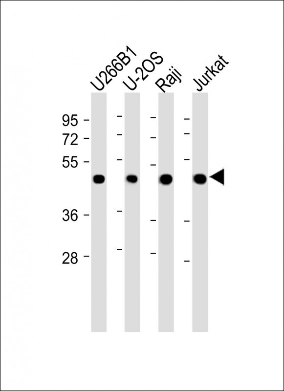 All lanes : Anti-ETV6 Antibody (N-term) at 1:2000 dilutionLane 1: U266B1 whole cell lysateLane 2: U-2OS whole cell lysateLane 3: Raji whole cell lysateLane 4: Jurkat whole cell lysateLysates/proteins at 20 µg per lane
