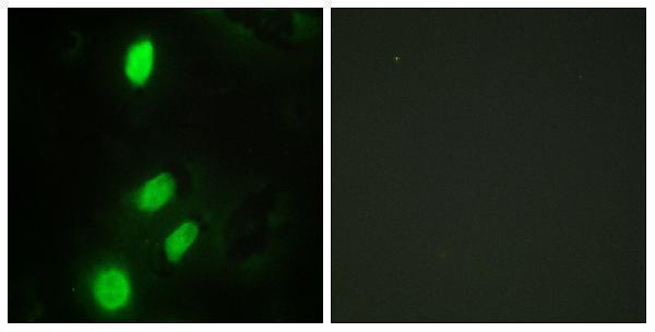 a00361 etv6 primary antibodies if testing 1
