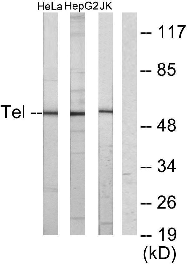 Western blot analysis of lysates from HeLa, HepG2, and Jurkat cells, using ETV6 Antibody