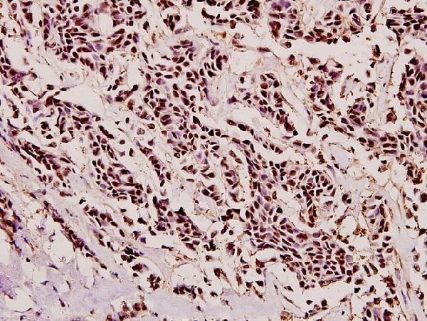 a00362 1 pycard primary antiboties ihc testing 2