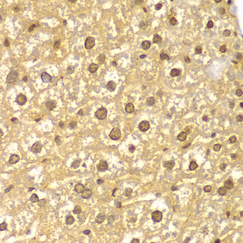 Immunohistochemistry of paraffin-embedded human colon using ASC/TMS1 Rabbit pAb  at dilution of 1:150 