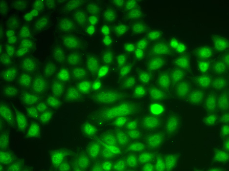 a00362 2 pycard primary antiboties ihc testing 4