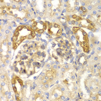 Western blot analysis of extracts of Rat spleen, using ASC/TMS1 antibody  at 1:1000 dilution