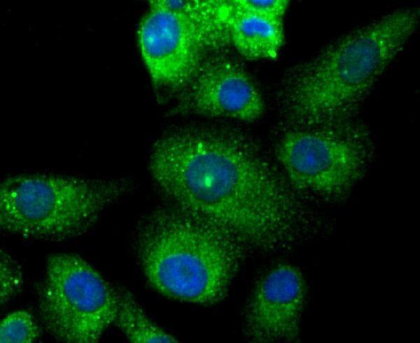 ICC staining TMS1 in A549 cells (green)
