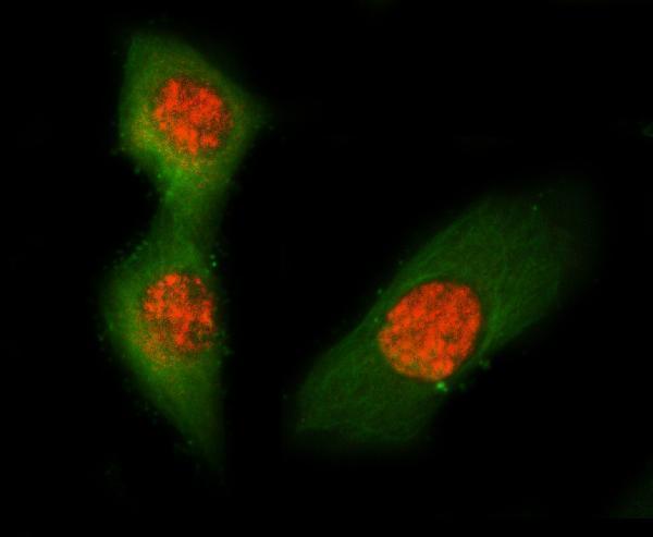  IF analysis of ASC/TMS1/Pycard using anti-ASC/TMS1/Pycard antibody (A00362-5) and anti-Tubulin Alpha antibody (M03989-3)
