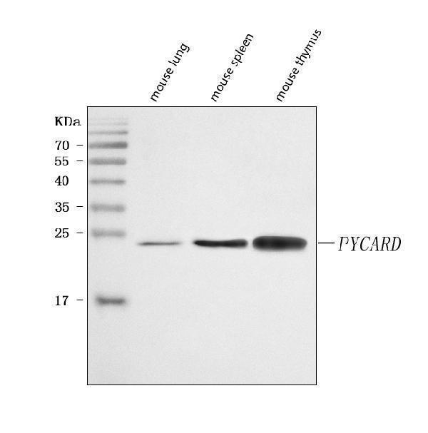  Western blot analysis of ASC/TMS1/Pycard using anti-ASC/TMS1/Pycard antibody (A00362-5)