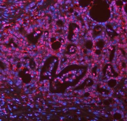 a00362 6 asc primary antibodies if testing 10
