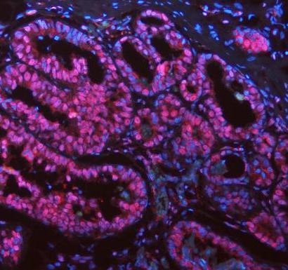 a00362 6 asc primary antibodies if testing 9