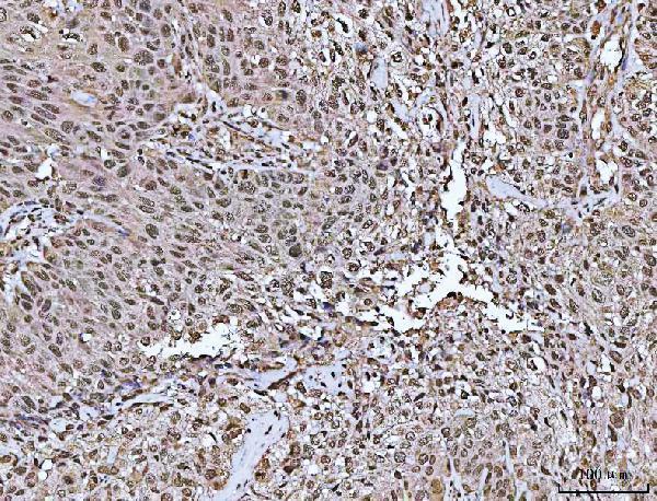  IHC analysis of ASC/TMS1/PYCARD using anti-ASC/TMS1/PYCARD antibody (A00362-6)