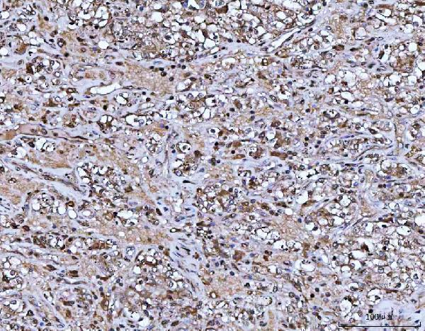  IHC analysis of ASC/TMS1/PYCARD using anti-ASC/TMS1/PYCARD antibody (A00362-6)