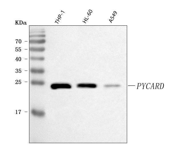  Western blot analysis of ASC/TMS1/PYCARD using anti-ASC/TMS1/PYCARD antibody (A00362-6)