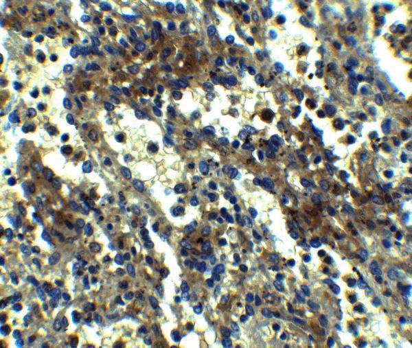 a00362 pycard primary antibodies ihc testing 4
