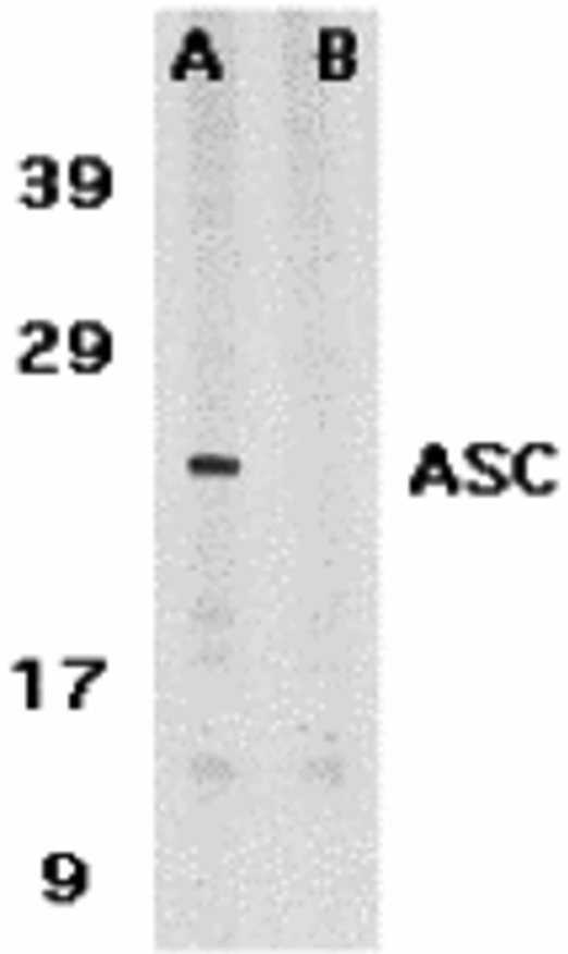 Western Blot Validation in Human HL60 Cells
Loading: 15 μg of lysates per lane