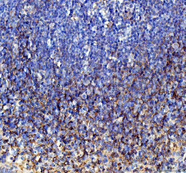 IHC analysis of TNFSF11 using anti-TNFSF11 antibody (A00363-2)