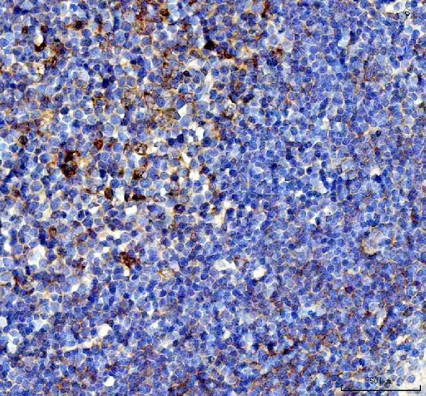 IHC analysis of TNFSF11 using anti-TNFSF11 antibody (A00363-2)