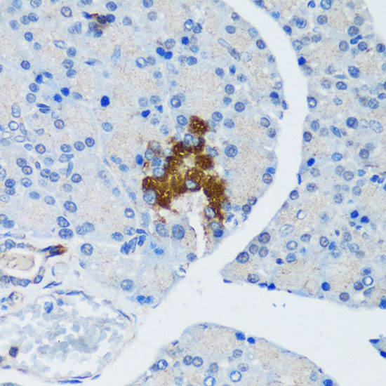 Immunohistochemistry of paraffin-embedded rat pancreatic islet using TSC1 antibody  at dilution of 1:200 