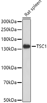 Western blot analysis of extracts of Rat spleen, using TSC1 antibody  at 1:1000 dilution