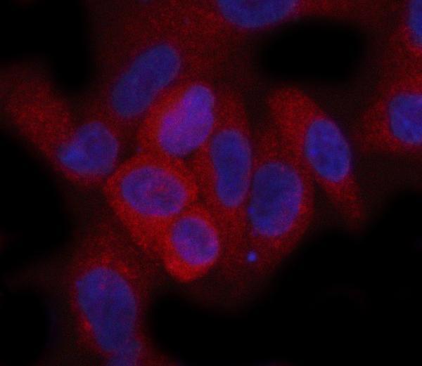 a00365 2 tsc1 primary antibodies if testing 7