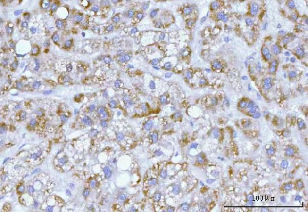  IHC analysis of Hamartin/TSC1 using anti-Hamartin/TSC1 antibody (A00365-2)