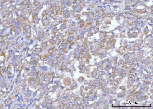  IHC analysis of Hamartin/TSC1 using anti-Hamartin/TSC1 antibody (A00365-2)