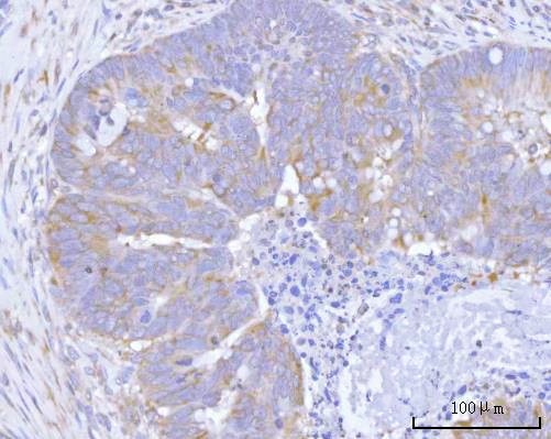 a00365 2 tsc1 primary antibodies ihc testing 4