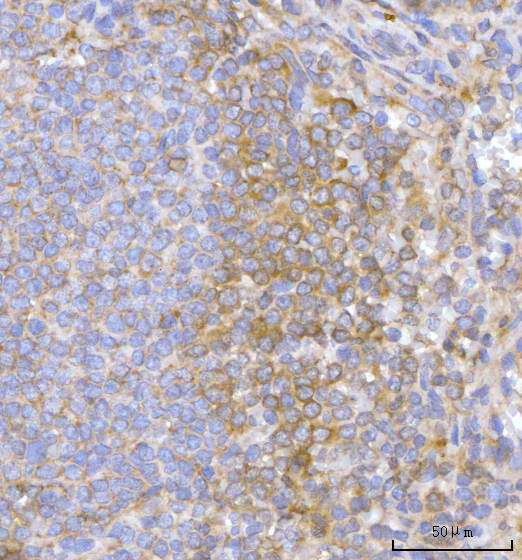 a00365 2 tsc1 primary antibodies ihc testing 5