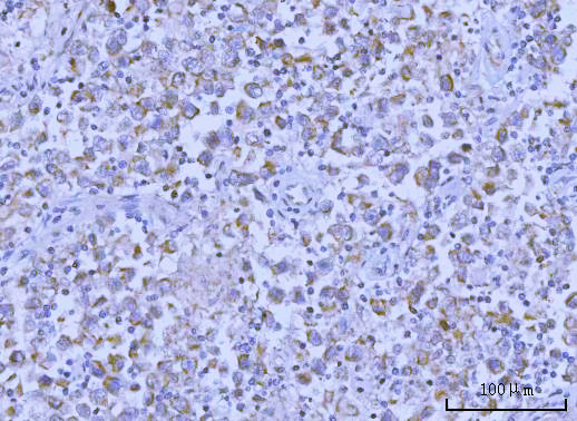 a00365 2 tsc1 primary antibodies ihc testing 6