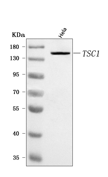  Western blot analysis of Hamartin/TSC1 using anti-Hamartin/TSC1 antibody (A00365-2)