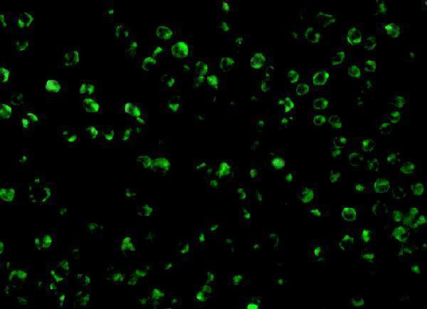 Immunofluorescence of TSC1 in L1210 cells with TSC1 antibody at 10 μg/mL